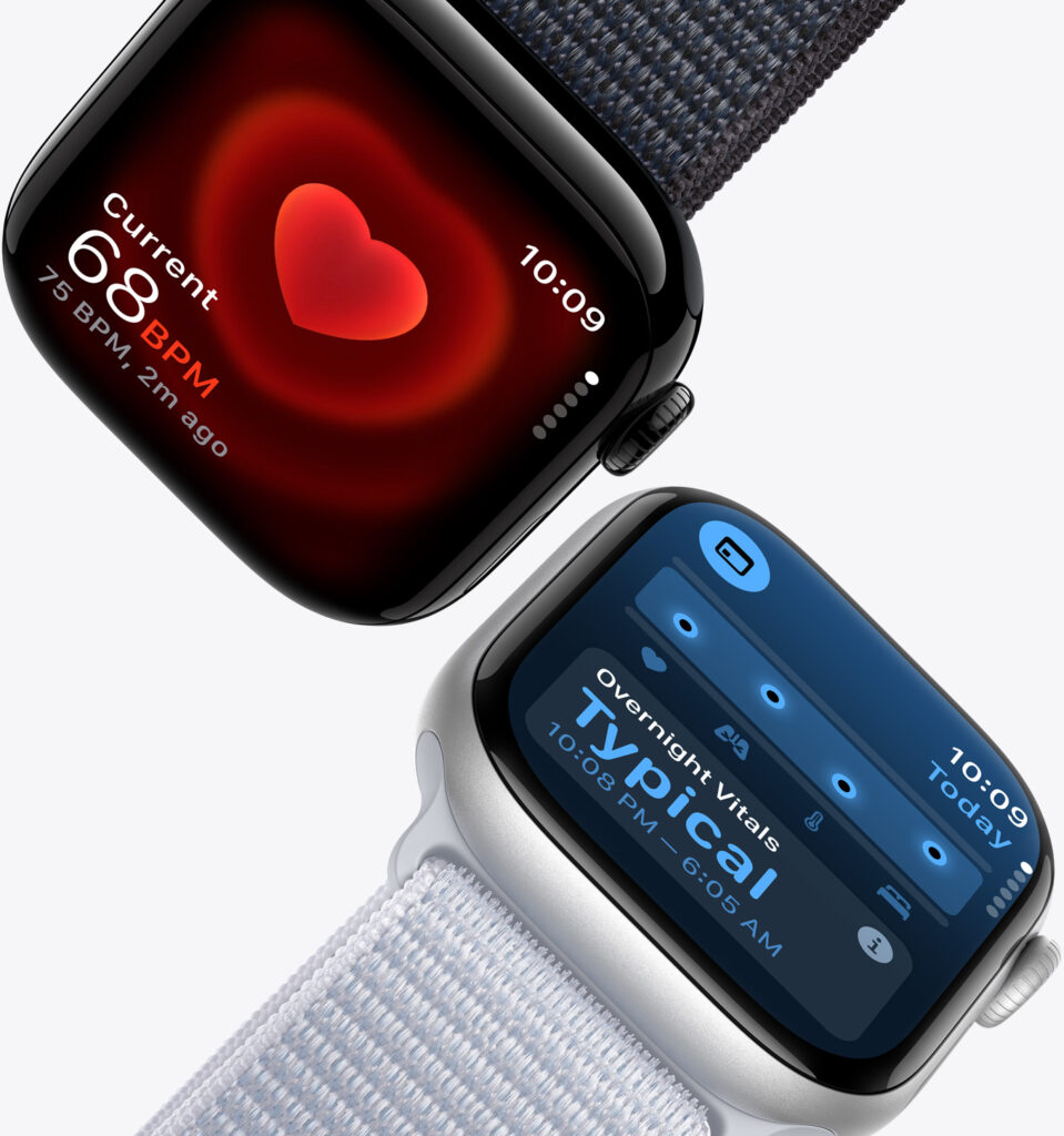 Apple watch series 10